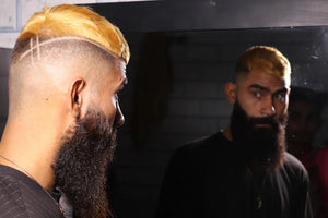 The Role of Genetics in Hair Loss Explained